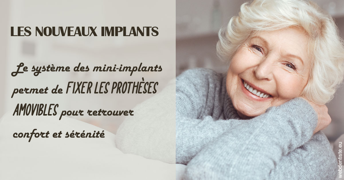 https://dr-emilie-lacaze.chirurgiens-dentistes.fr/Les nouveaux implants 1