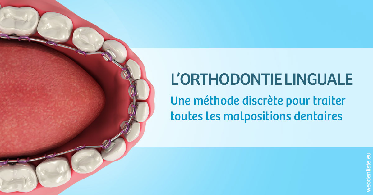 https://dr-emilie-lacaze.chirurgiens-dentistes.fr/L'orthodontie linguale 1
