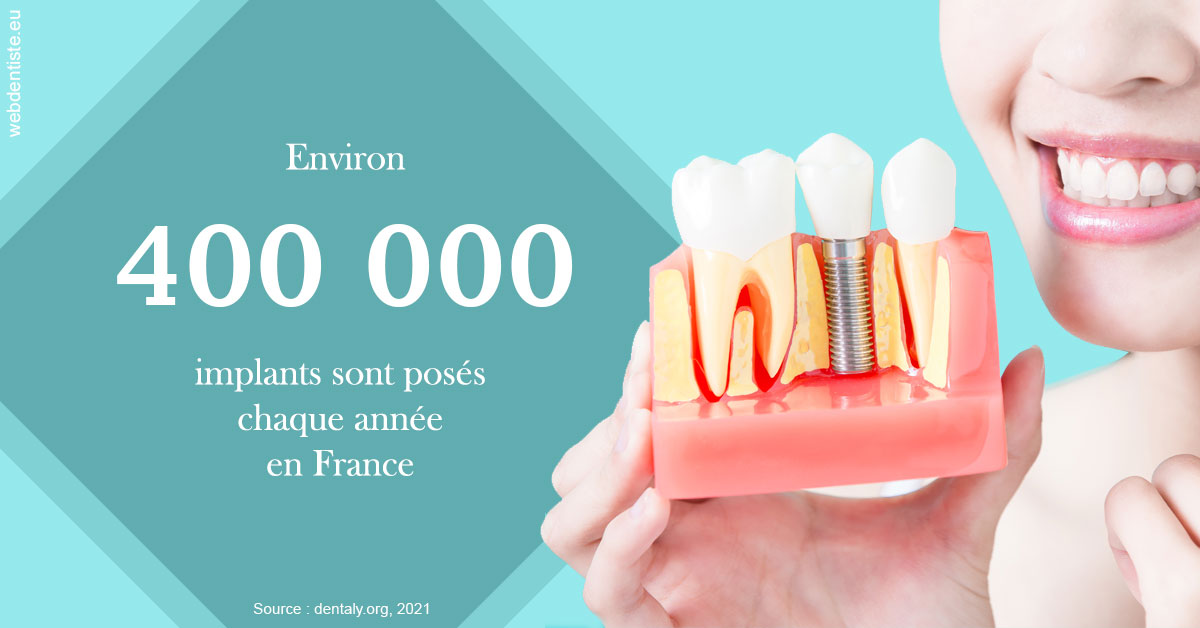 https://dr-emilie-lacaze.chirurgiens-dentistes.fr/Pose d'implants en France 2
