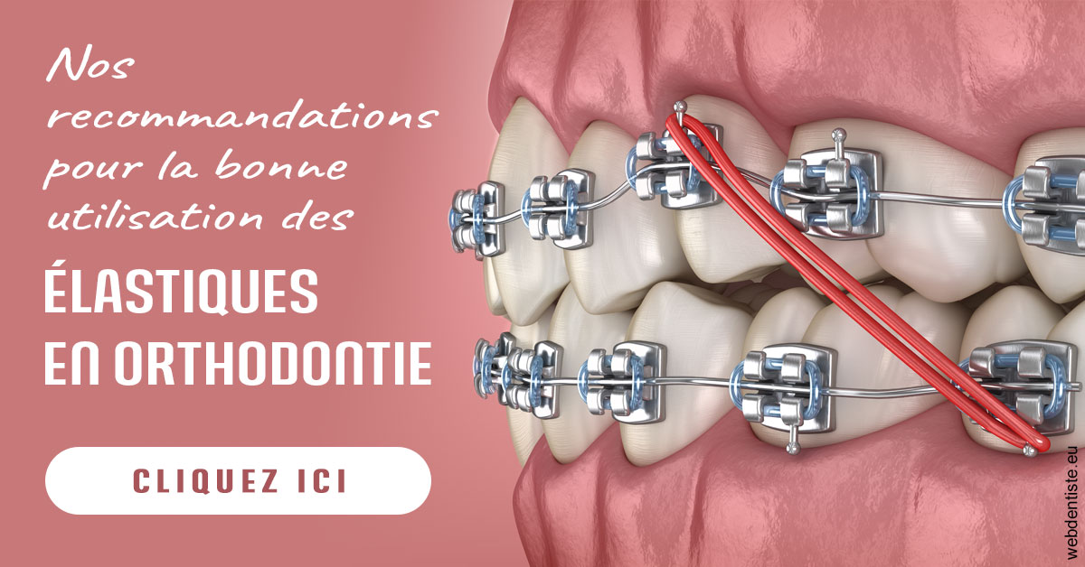 https://dr-emilie-lacaze.chirurgiens-dentistes.fr/Elastiques orthodontie 2